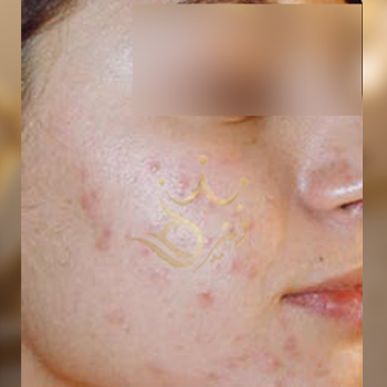 نمونه کار مزونیدلینگ خانوم احمدپور