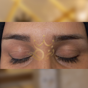 نمونه کار کاشت ابرو خانم گوهری