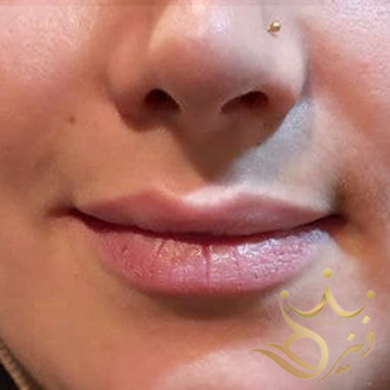 نمونه کارت ترزیق ژل خانوم صالحی