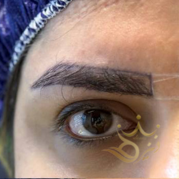 کاشت ابرو مشهد خانم اسفندیاری