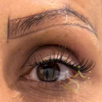 کاشت ابرو مشهد خانم موسوی
