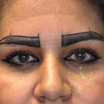 کاشت ابرو مشهد خانم موسوی زاده