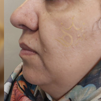 نمونه هایفوتراپی خانم قوچانی