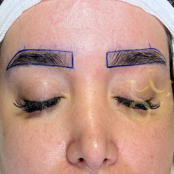 کاشت ابرو در مشهد خانم رفعتی مقدم