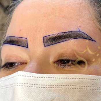 کاشت ابرو در مشهد خانم توکلیان