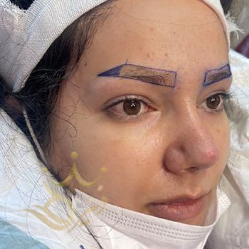 کاشت ابرو در مشهد خانم مومن نسب