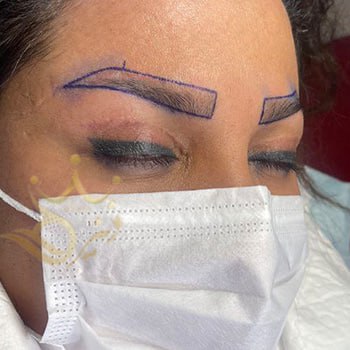 کاشت ابرو در مشهد خانم صابری