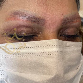 کاشت ابرو در مشهد خانم بابایی