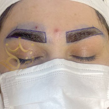 کاشت ابرو در مشهد خانم اسلامی نیا