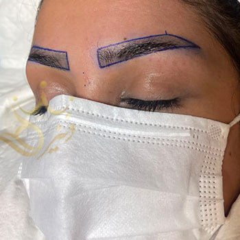 کاشت ابرو در مشهد خانم شمس