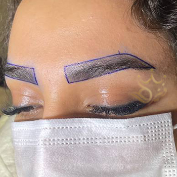 کاشت ابرو در مشهد خانم غفاریان