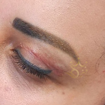کاشت ابرو در مشهد خانم رنجبر