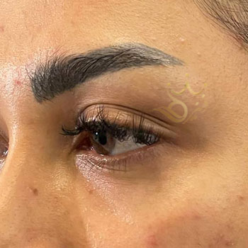 کاشت ابرو در مشهد خانم فرزانه