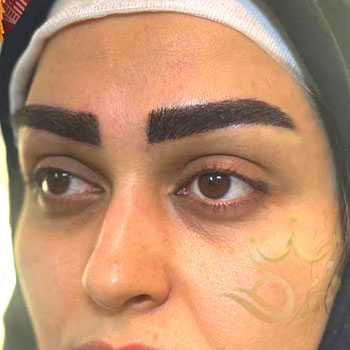 کاشت ابرو در مشهد خانم براتی