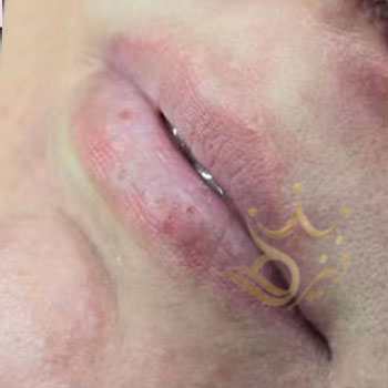 ژل لب در مشهد خانم تفقدی