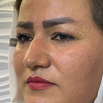 کاشت ابرو در مشهد خانم غفاری