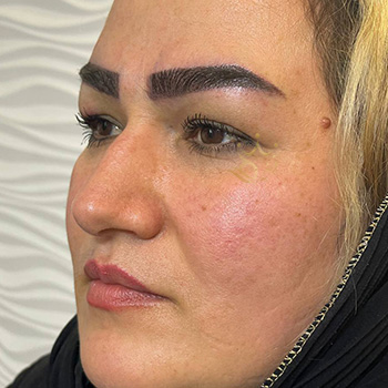 کاشت ابرو در مشهد خانم غفاری