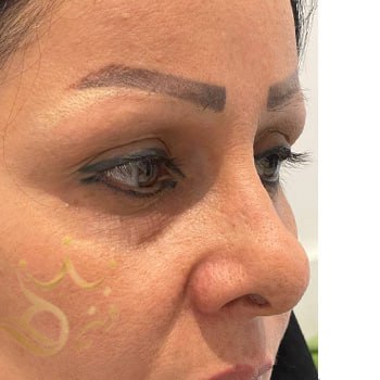 کاشت ابرو در مشهد خانم عزتی