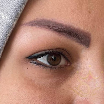 کاشت ابرو در مشهد خانم ستوده