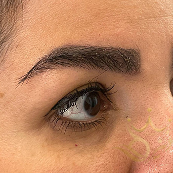 کاشت ابرو در مشهد خانم عابدی