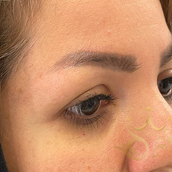 کاشت ابرو در مشهد خانم عابدی