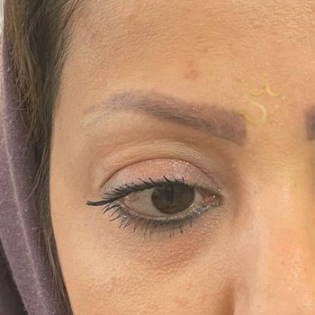 کاشت ابرو در مشهد خانم کلاته