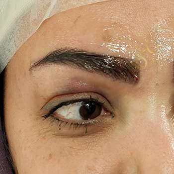 کاشت ابرو در مشهد خانم کلاته