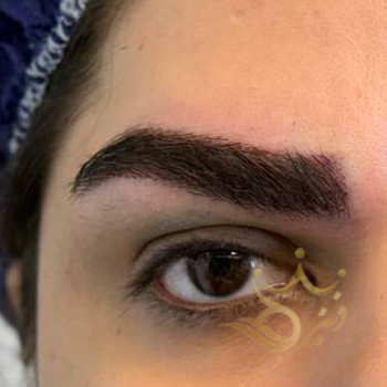 کاشت ابرو مشهد خانم اسفندیاری