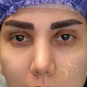 کاشت ابرو مشهد خانم ذاکری