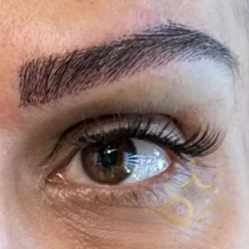 کاشت ابرو مشهد خانم موسوی