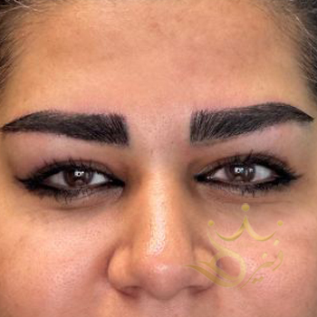 کاشت ابرو مشهد خانم موسوی زاده